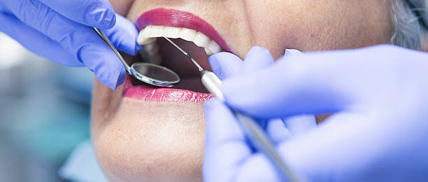 Best Emergency Dentist for Lost Fillings or Crowns in Lakewood, CO